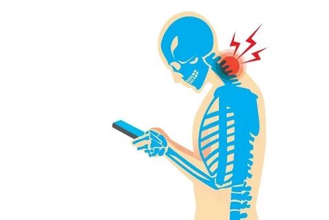 Mobile Phone Neck Syndrome: A Modern-Day Spine Issue