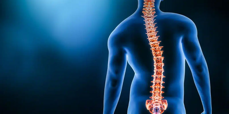 Myths vs Facts Scoliosis